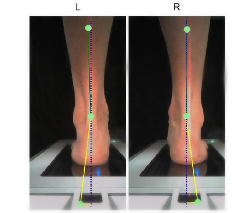 Investigaci&oacute;n biomec&aacute;nica